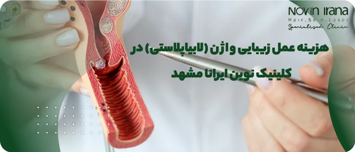 هزینه عمل زیبایی واژن (لابیاپلاستی) در کلینیک نوین ایرانا مشهد